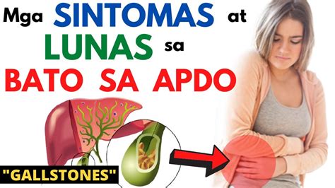 Sakit Sa Apdo: Mga Sintomas, Paggamot, At Pag.